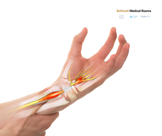Carpal tunnel release surgery