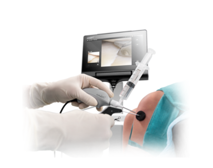 Nanoscope arthroscopic surgery 