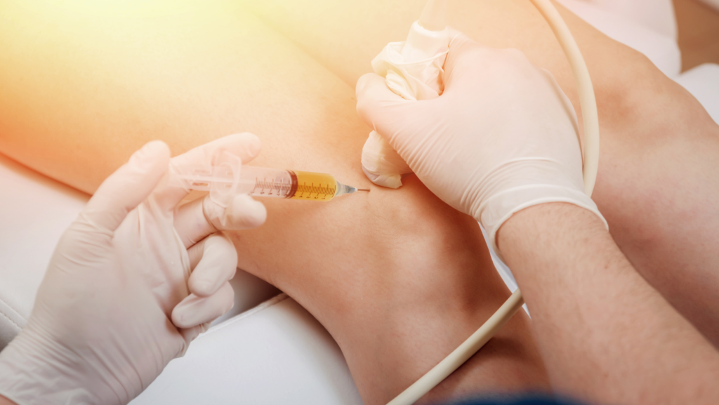 Ultrasound-guided cortisone injection in knee